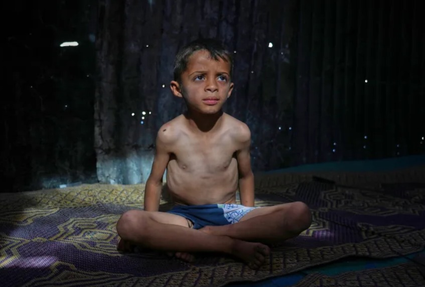 തീവ്ര ദാരിദ്ര്യത്തിന്റെ പിടിയിലമര്‍ന്ന് ഗാസ, എല്ലും തോലുമായി കുട്ടികള്‍